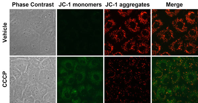 利用永生化表皮细胞评价化妆品蓝光防护功效