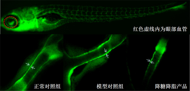 利用斑马鱼模型评价高血糖高血脂血管壁增厚改善功效