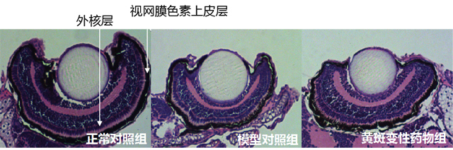 利用斑马鱼模型评价湿性黄斑变性防治作用