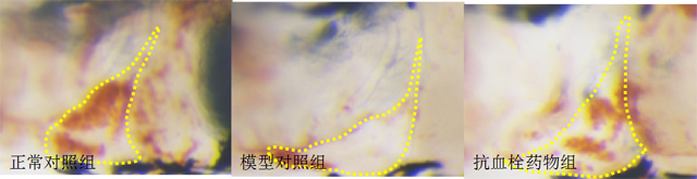 利用斑马鱼模型评价抗血管内皮损伤性血栓作用